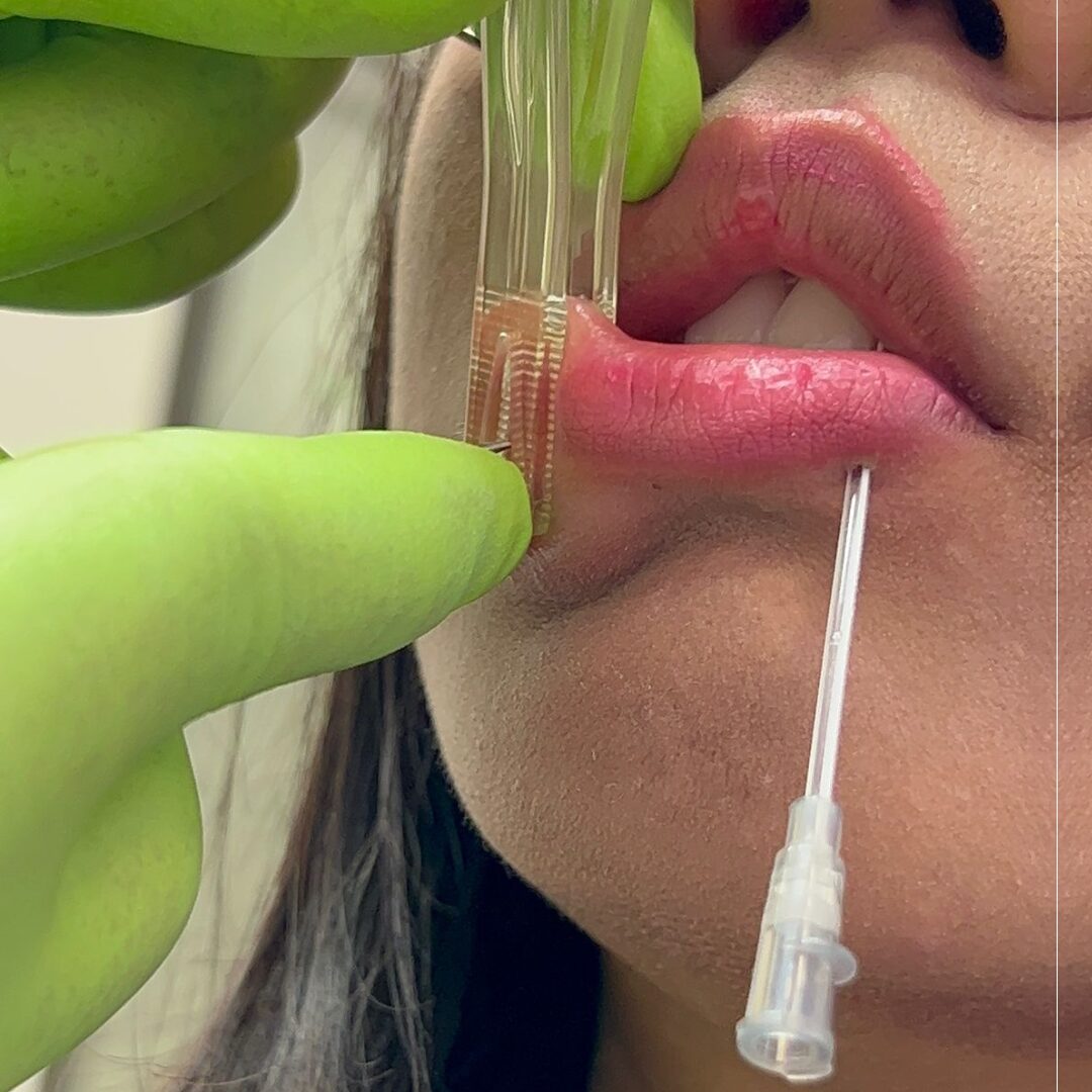Needle for Snake Bites Piercing