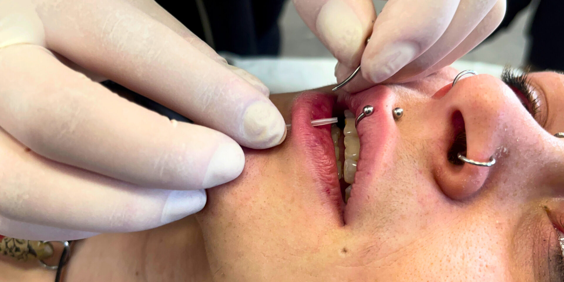 Safely performing a labret piercing
